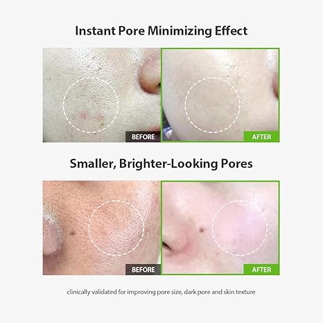 [Sérum cuidado de poros] SUNGBOON EDITOR Green Tomato Pore Lifting Ampoule+ 30ml