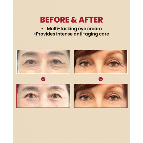 [Crema contorno de ojos] KSECRET SEOUL 1988 Eye Cream : Retinal Liposome 4% + Fermented Bean