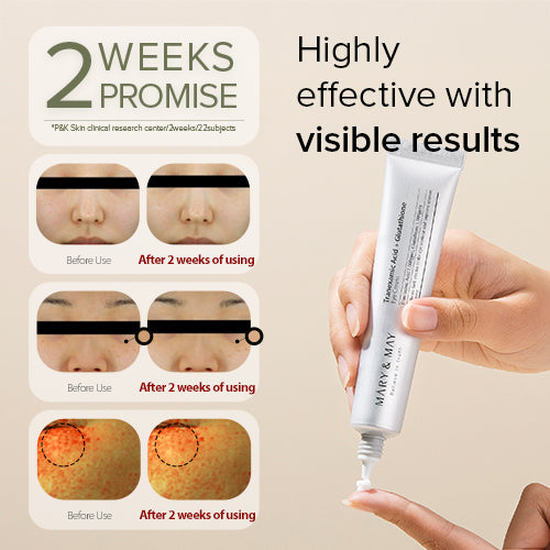 [Crema contorno de ojos] Mary&May Tranexamic Acid+ Glutathion Eye Cream 30ml