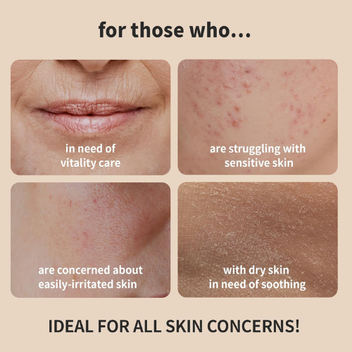 [Tónico facial] Benton *renew* Snail Bee High Content Skin Toner 150ml